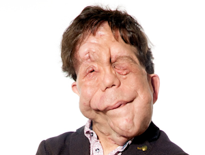 adam pearson